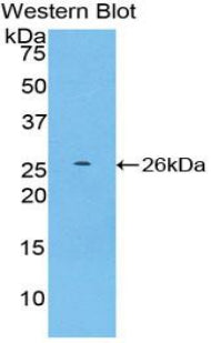 DAB staining on IHC-P; Samples: Mouse Kidney Tissue;  Primary Ab: 20µg/ml Rabbit Anti-Mouse CASP11 A