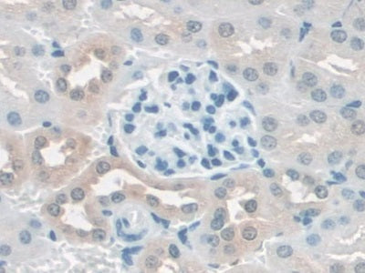 DAB staining on IHC-P; Samples: Mouse Kidney Tissue)