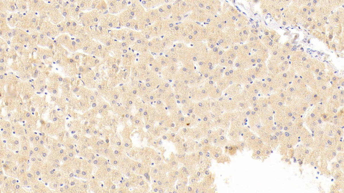 Macrophage Inflammatory Protein 1 Beta (MIP1b) Polyclonal Antibody - image 3