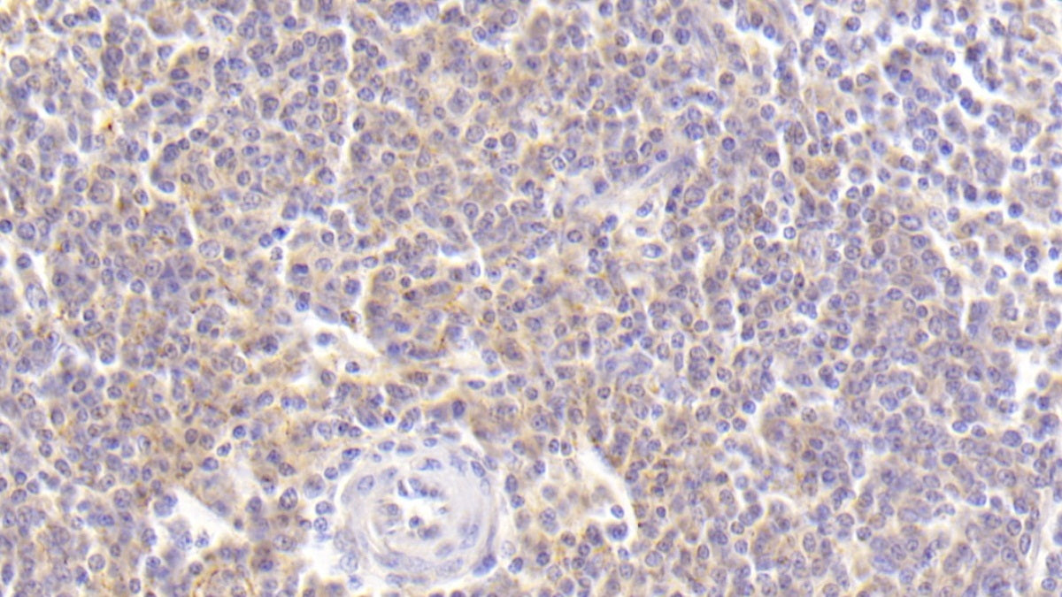 Macrophage Derived Chemokine (MDC) Polyclonal Antibody - image 3