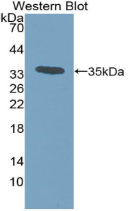 Monocyte Chemotactic Protein 3 (MCP3) Polyclonal Antibody - image 2