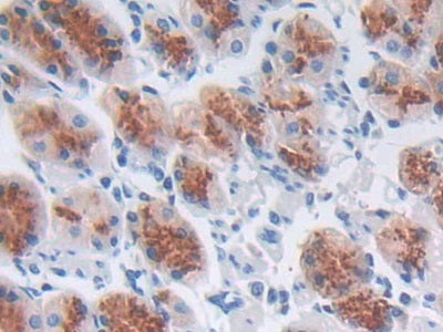 DAB staining on fromalin fixed paraffin-embedded Kidney tissue)