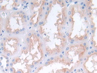 Monocyte Chemotactic Protein 2 (MCP2) Polyclonal Antibody - image 4