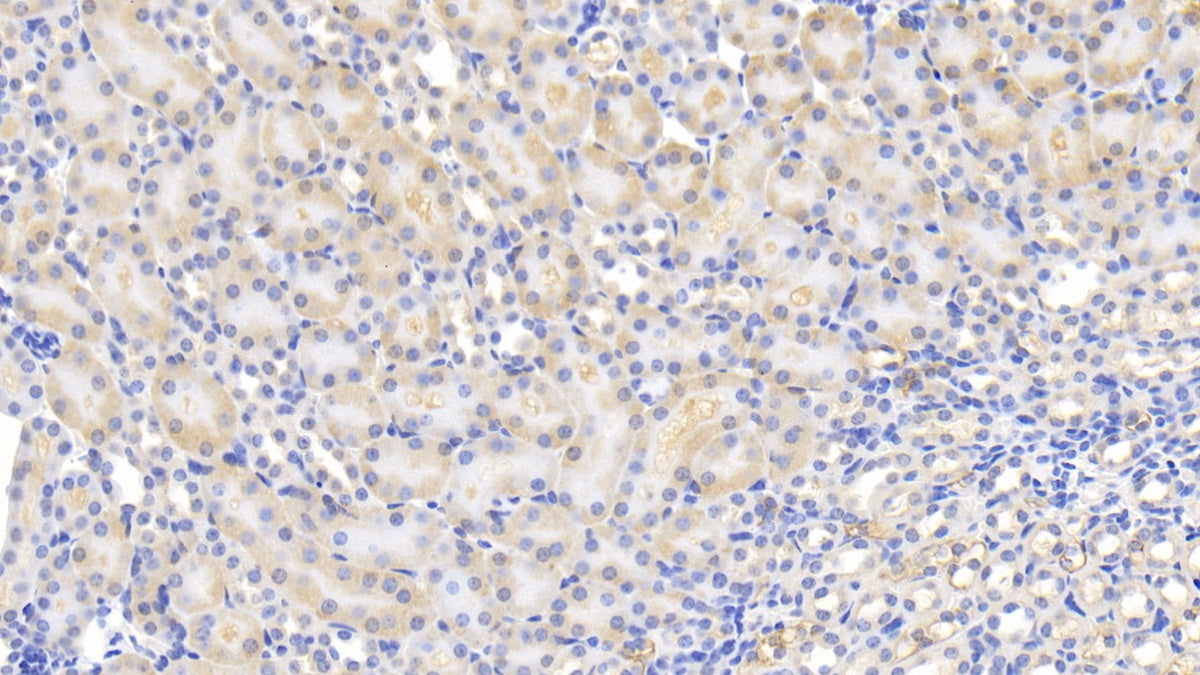 DABstainingonIHC-P.Samples:MouseTissue)