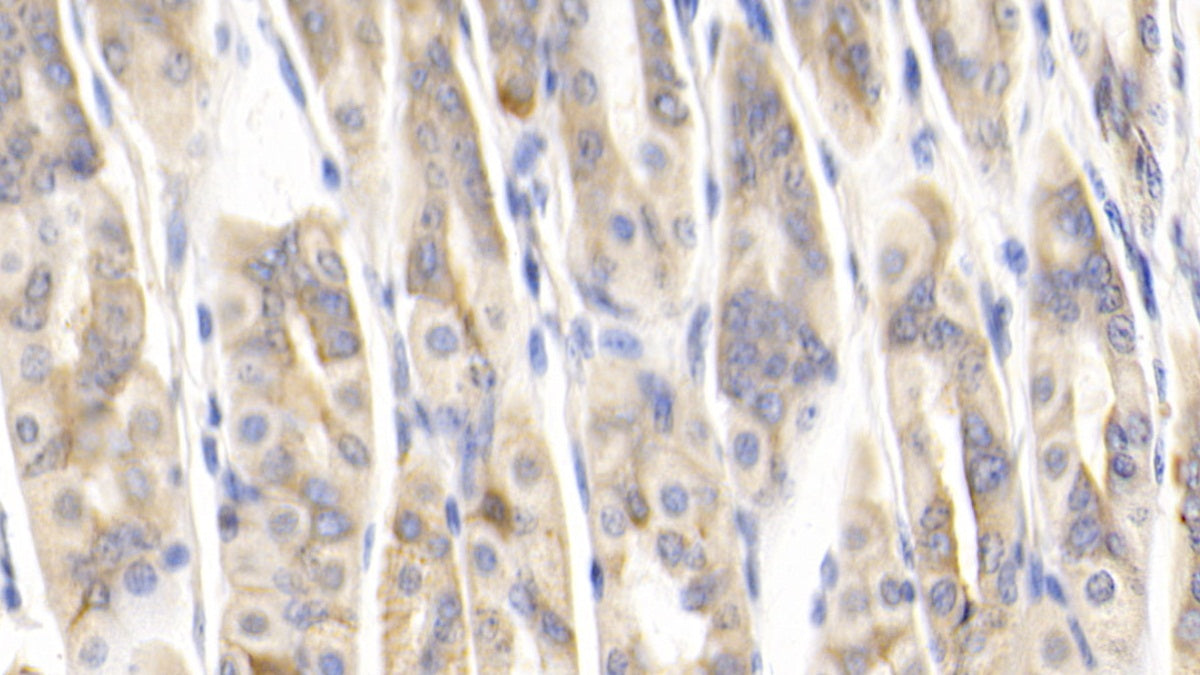 Monocyte Chemotactic Protein 1 (MCP1) Polyclonal Antibody - image 4