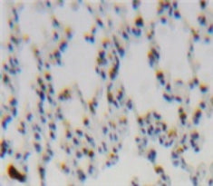 Monocyte Chemotactic Protein 1 (MCP1) Polyclonal Antibody - image 3