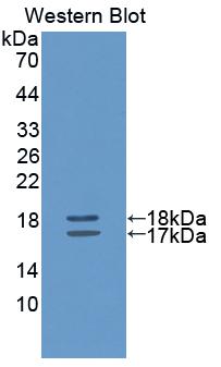 Interleukin 2 (IL2) Polyclonal Antibody - image 2