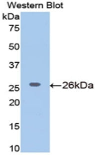 Meningioma Expressed Antigen 5 (MGEA5) Polyclonal Antibody - image 2