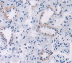 Meningioma Expressed Antigen 5 (MGEA5) Polyclonal Antibody - image 3