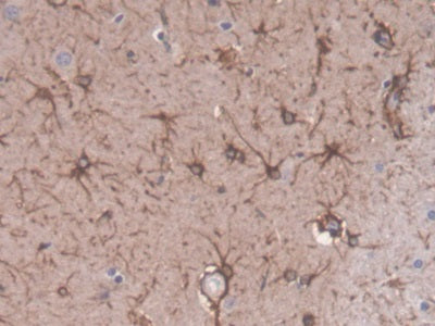 DAB staining on fromalin fixed paraffin- embedded Kidney tissue)