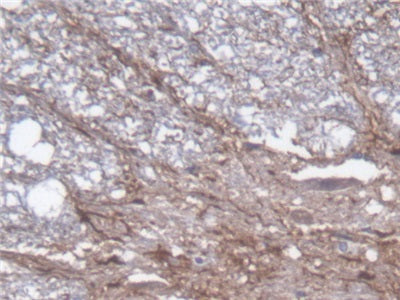 Glial Fibrillary Acidic Protein (GFAP) Polyclonal Antibody - image 5