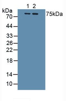 Western Blot; Sample: Recombinant IL1R1, Human.