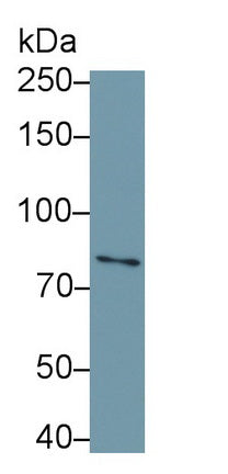 DAB staining on IHC-P; Samples: Human Kidney Tissue; Primary Ab: 30µg/ml Rabbit Anti-Human IL1R1 Antibody Second Ab: 2µg/mL HRP-Linked Caprine Anti-Rabbit IgG Polyclonal Antibody