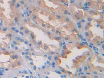 Interleukin 1 Receptor Type I (IL1R1) Polyclonal Antibody - image 4