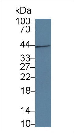 Western Blot; Sample: Recombinant protein.