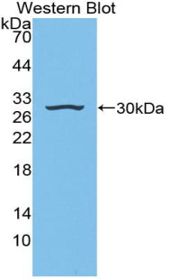DAB staining on IHC-P; Samples: Mouse Liver Tissue;  Primary Ab: 20μg/ml Rabbit Anti-Mouse IGFBP4 Antibody Second Ab: 2µg/mL HRP-Linked Caprine Anti-Rabbit IgG Polyclonal Antibody