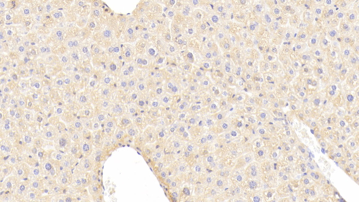 Insulin Like Growth Factor Binding Protein 4 (IGFBP4) Polyclonal Antibody - image 4