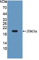 Insulin Like Growth Factor Binding Protein 3 (IGFBP3) Polyclonal Antibody - image 2