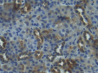 Insulin Like Growth Factor Binding Protein 3 (IGFBP3) Polyclonal Antibody - image 4