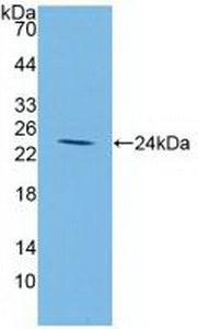 DAB staining on IHC-P; Samples: Human Liver Tissue; Primary Ab: 20µg/ml Rabbit Anti-Human IGFBP2 Antibody Second Ab: 2µg/mL HRP-Linked Caprine Anti-Rabbit IgG Polyclonal Antibody