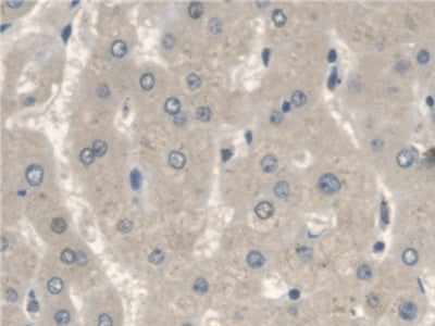 DAB staining on IHC-P; Samples: Human Kidney Tissue.