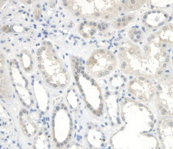 Insulin Like Growth Factor Binding Protein 2 (IGFBP2) Polyclonal Antibody - image 5