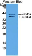 Insulin Like Growth Factor Binding Protein 1 (IGFBP1) Polyclonal Antibody - image 2