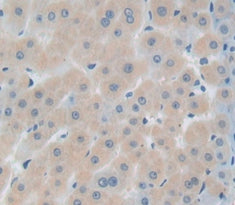 Insulin Like Growth Factor Binding Protein 1 (IGFBP1) Polyclonal Antibody - image 3