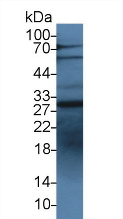 Western Blot; Sample: Recombinant protein.