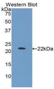DAB staining on IHC-P; Samples: Bovine Testis Tissue;  Primary Ab: 20μg/ml Rabbit Anti-Bovine IGFBP1 Antibody Second Ab: 2µg/mL HRP-Linked Caprine Anti-Rabbit IgG Polyclonal Antibody