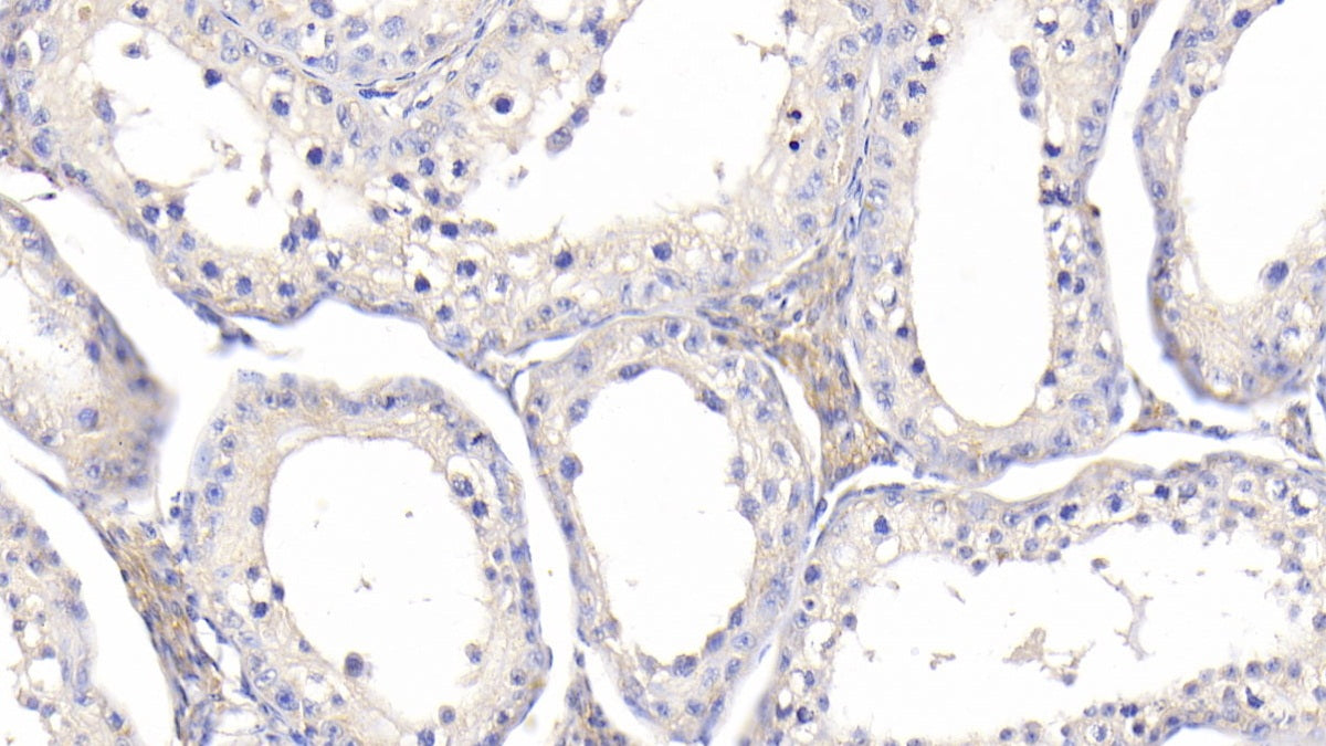 Insulin Like Growth Factor Binding Protein 1 (IGFBP1) Polyclonal Antibody - image 4