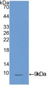 Insulin Like Growth Factor 1 (IGF1) Polyclonal Antibody - image 2