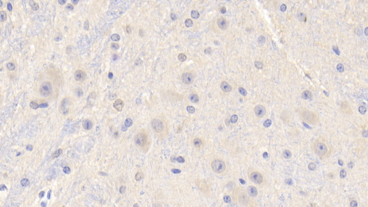 DAB staining on fromalin fixed paraffin-embedded liver tissue)