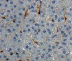 Insulin Like Growth Factor 1 (IGF1) Polyclonal Antibody - image 4