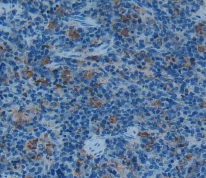 Interferon Gamma (IFNg) Polyclonal Antibody - image 3