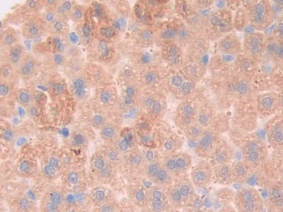 Glycoprotein 130 (gp130) Polyclonal Antibody - image 4