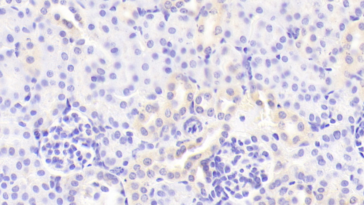 DAB staining on fromalin fixed paraffin- embedded lung tissue)