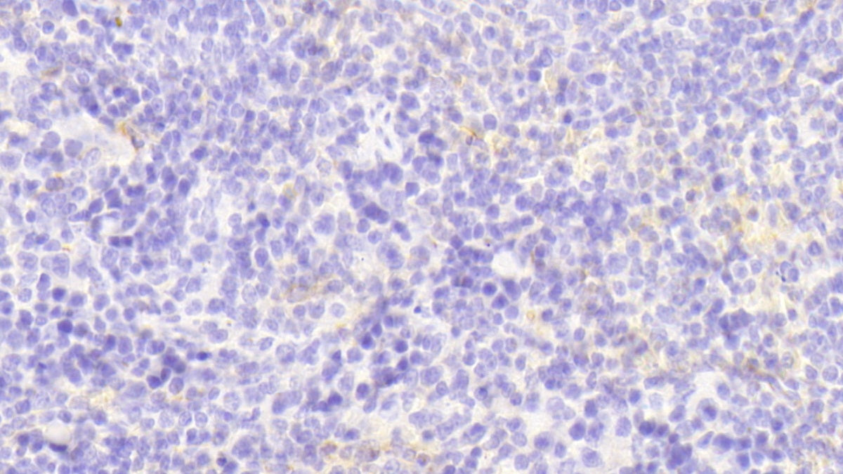 Colony Stimulating Factor 2, Granulocyte Macrophage (GM-CSF) Polyclonal Antibody - image 4