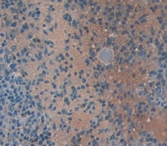 Chemokine (C-X-C Motif) Ligand 1 (CXCL1) Polyclonal Antibody - image 3
