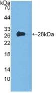 DAB staining on IHC-P; Samples: Mouse Skeletal muscle Tissue; Primary Ab: 10µg/ml Rabbit Anti-Mouse Flt3 Antibody Second Ab: 2µg/mL HRP-Linked Caprine Anti-Rabbit IgG Polyclonal Antibody