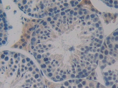 FMS Like Tyrosine Kinase 3 (Flt3) Polyclonal Antibody - image 5