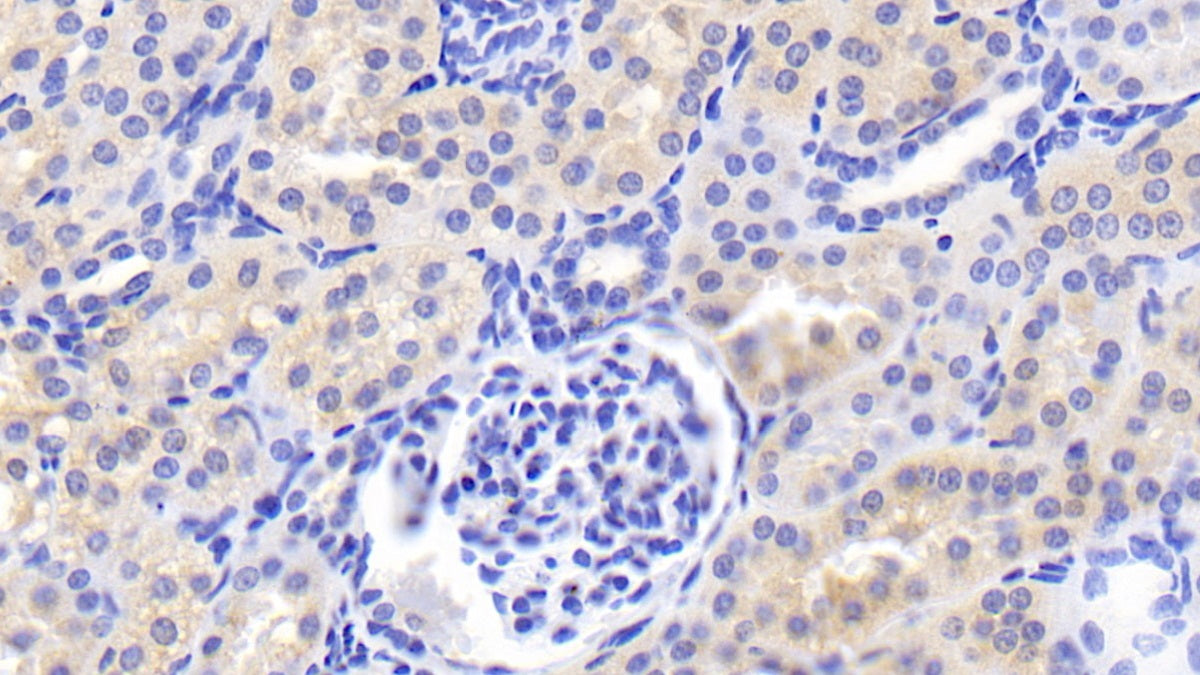 DAB staining on IHC-P; Samples: Porcine Cardiac Muscle Tissue;  Primary Ab: 20μg/ml Rabbit Anti-Porcine FGF1 Antibody Second Ab: 2µg/mL HRP-Linked Caprine Anti-Rabbit IgG Polyclonal Antibody
