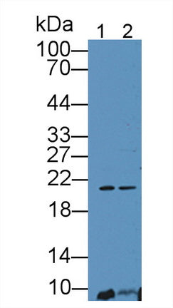 DAB staining on IHC-P; Samples: Human Placenta Tissue;  Primary Ab: 20μg/ml Rabbit Anti-Porcine EPO Antibody Second Ab: 2µg/mL HRP-Linked Caprine Anti-Rabbit IgG Polyclonal Antibody