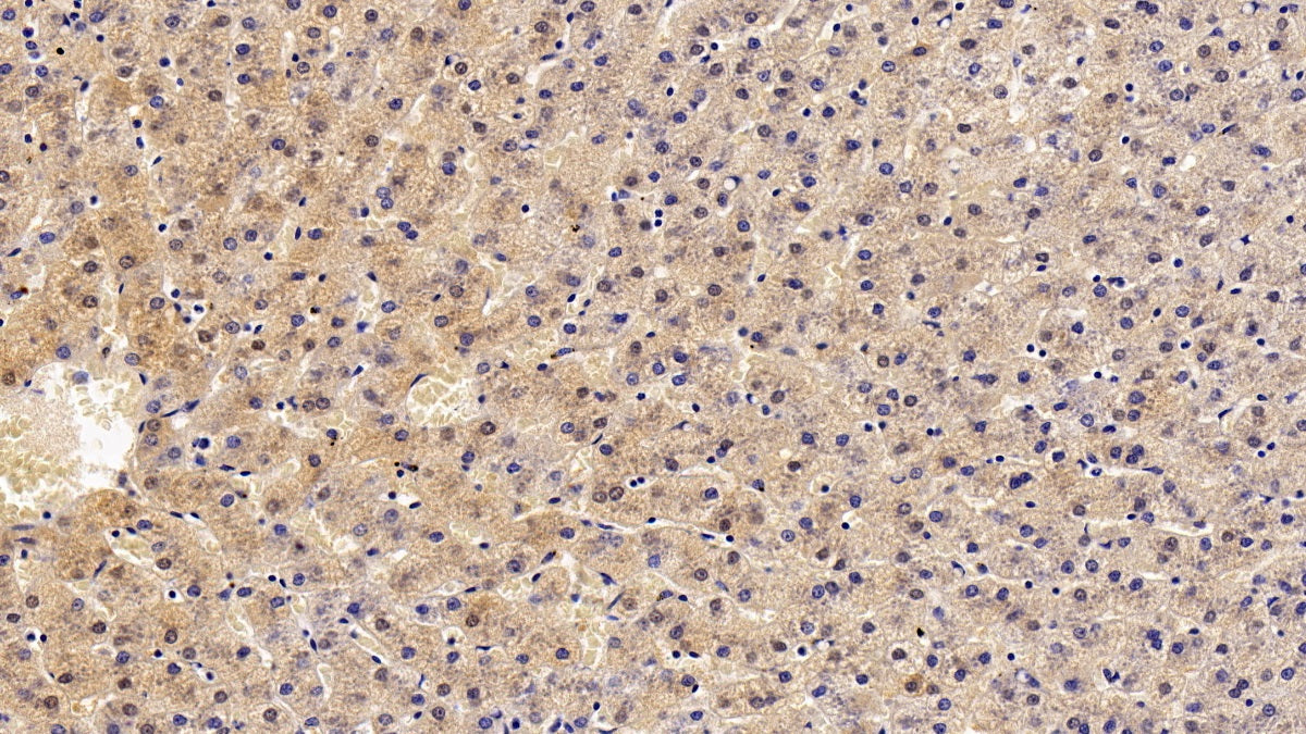 DABstainingonIHC-P.Samples:HumanTissue)