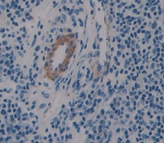 Endocrine Gland Derived Vascular Endothelial Growth Factor (EG-VEGF) Polyclonal Antibody - image 3