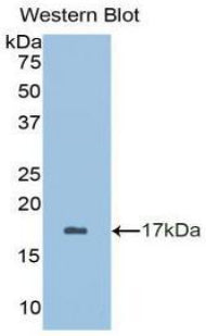 Brain Derived Neurotrophic Factor (BDNF) Polyclonal Antibody - image 2