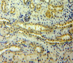 Angiopoietin 2 (ANGPT2) Polyclonal Antibody - image 4