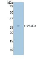 Angiopoietin 2 (ANGPT2) Polyclonal Antibody - image 2