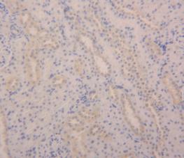 Angiopoietin 2 (ANGPT2) Polyclonal Antibody - image 3