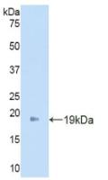 Angiopoietin 2 (ANGPT2) Polyclonal Antibody - image 2